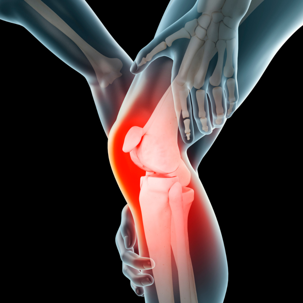 What Can Cause Knee Pain Without Injury? Karnadilim
