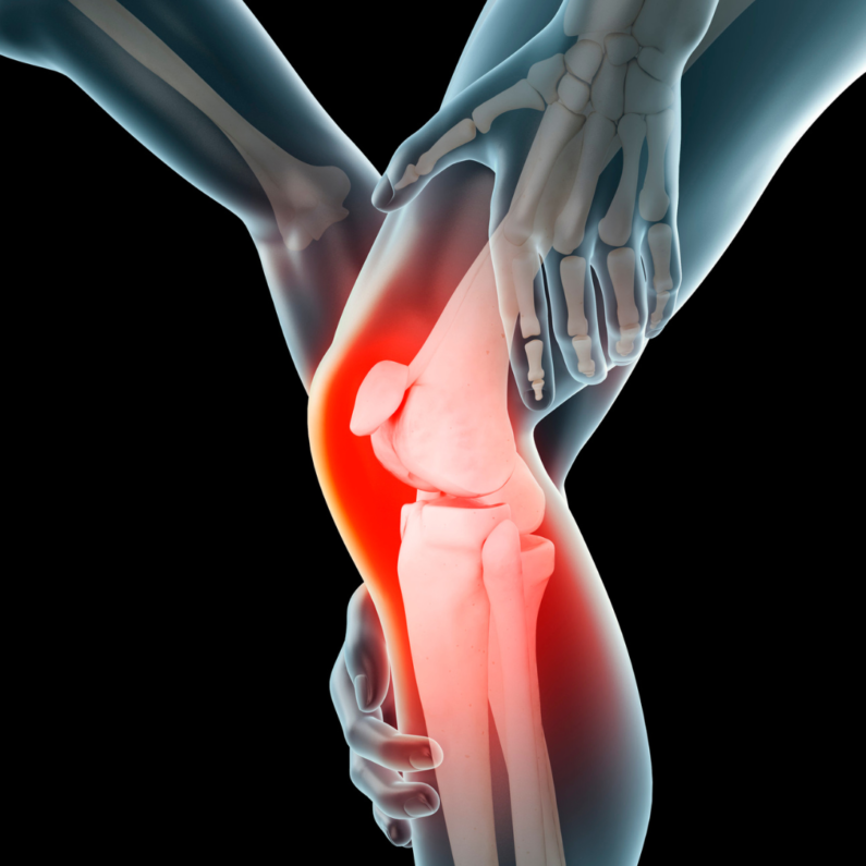 What Can Cause Knee Pain Without Injury?